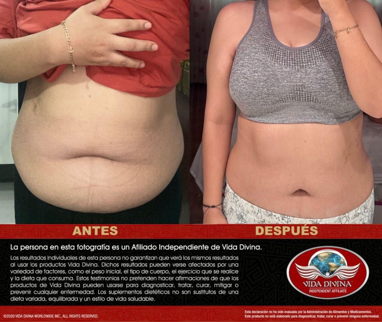 Transformación 1